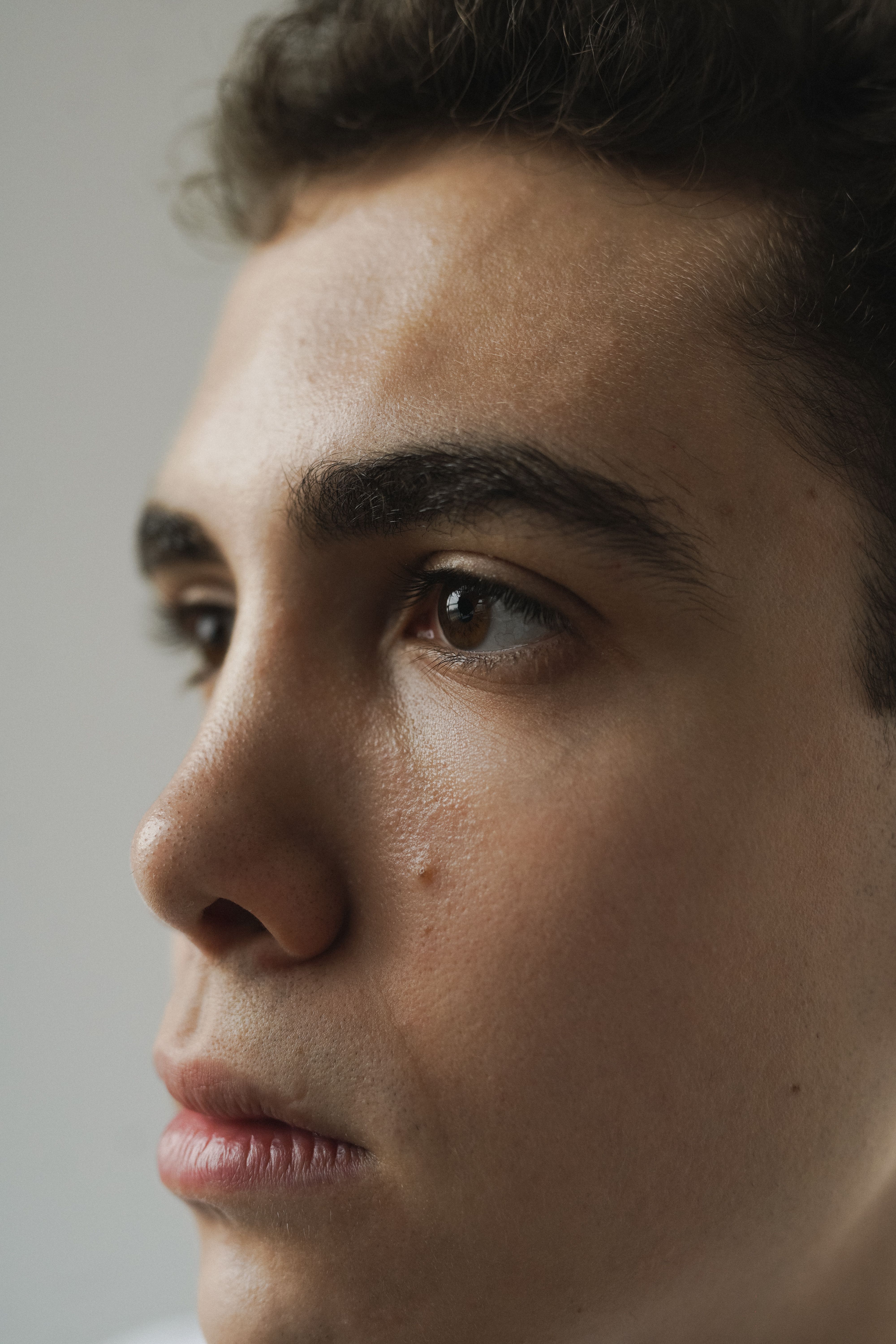 Depilação a laser masculina — Glabela