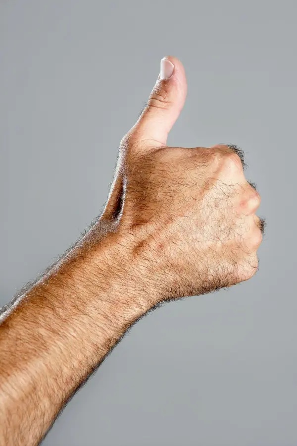 Depilação a laser masculina — Mãos