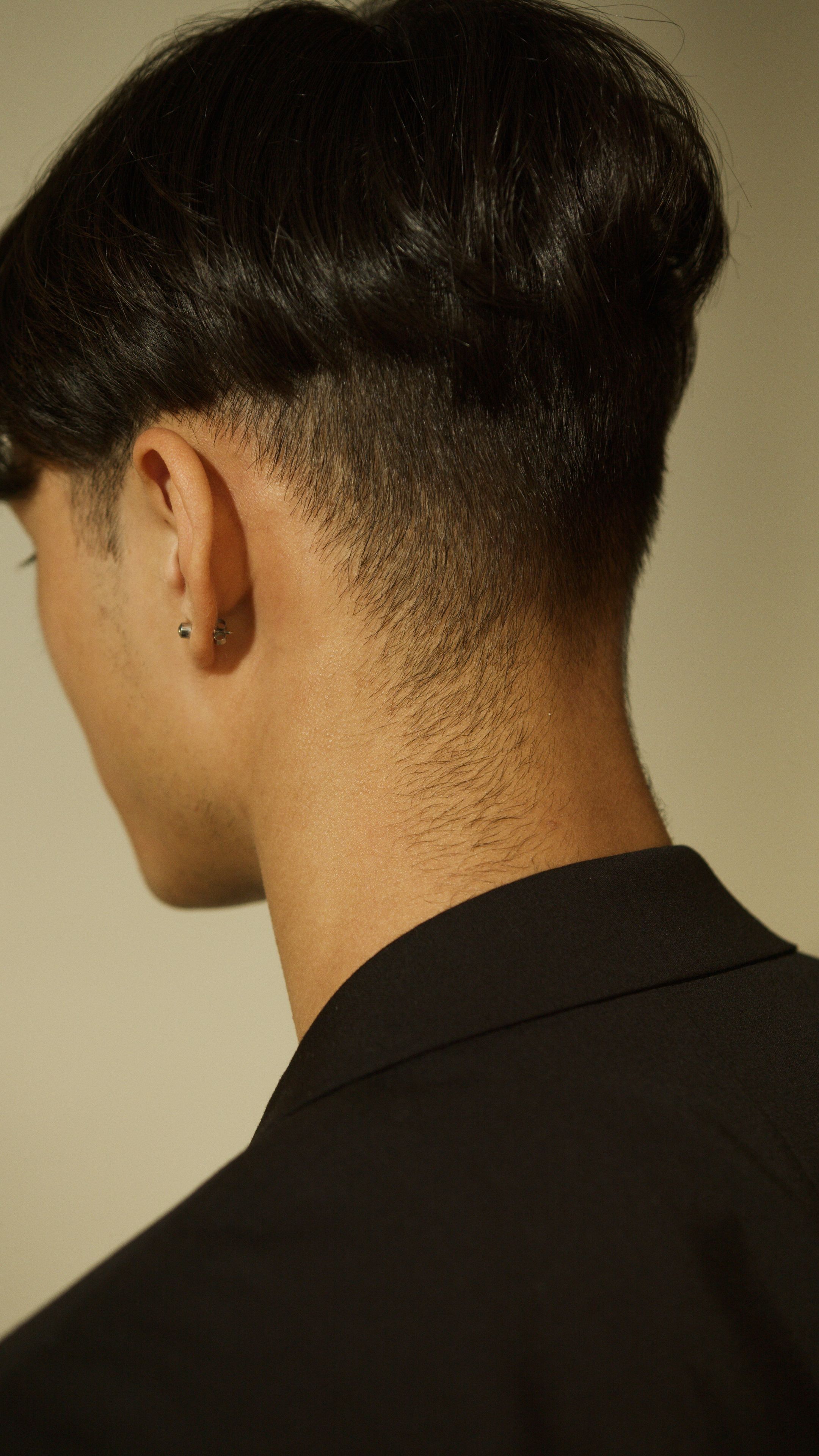 Depilação a laser masculina — Nuca