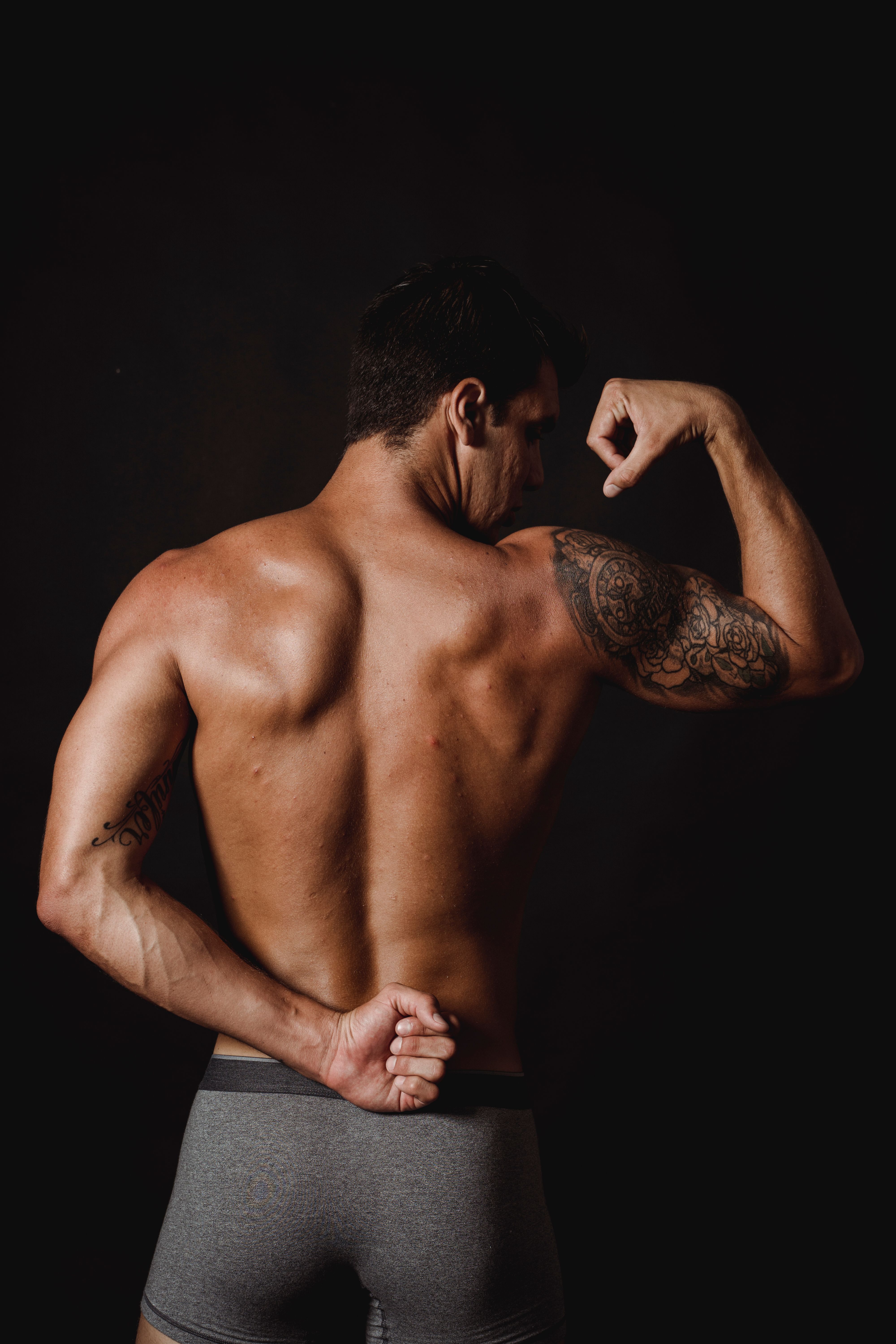 Depilação a laser masculina — Perianal